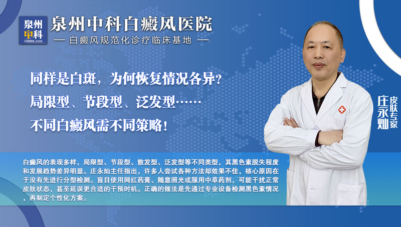 福建泉州中科皮膚白癜風醫院莊永燦主任科普：白斑反復不見好？先查黑色素脫失程度再分型